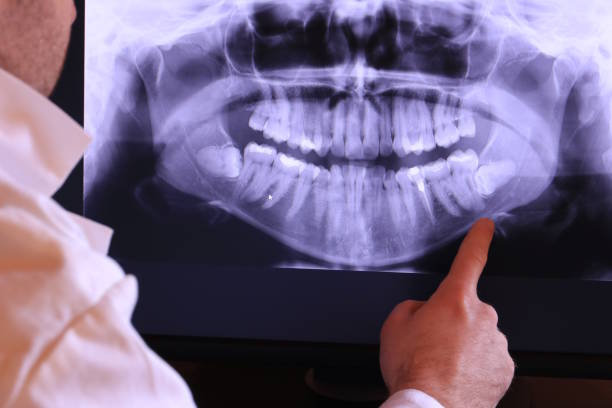 Best Emergency Gum Pain Relief  in Marbleton, WY