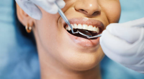 Best Tooth Infection Emergency Dentist  in Marbleton, WY