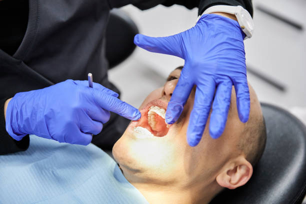 Best Chipped Tooth Repair Near Me  in Marbleton, WY